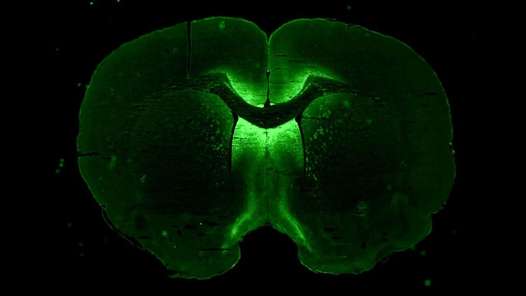 Kultur jaringan dari sel-sel otak yang dikembangkan dalam lingkungan dengan gravitasi mikro. Organoid otak ini bisa digunakan untuk menentukan terapi yang tepat bagi penderita sejumlah penyakit neurologis, seperti alzheimer, parkinson, hingga migrain.