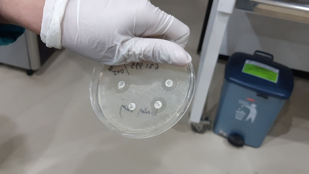 Petugas menunjukkan berbagai alat yang digunakan untuk melakukan tes kultur di laboratorium mikrobiologi milik Rumah Sakit Mardi Rahayu, Kudus, Jawa Tengah, Senin (12/2/2024). Tes kultur berguna untuk mengetahui jenis bakteri yang menimbulkan penyakit.