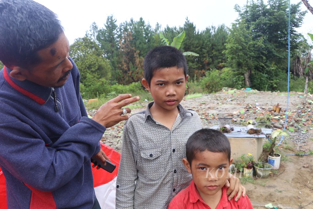 Korban gempa bumi menunjukkan kepala anaknya yang terluka di Desa Sisordak, Kecamatan Parmonangan, Kabupaten Tapanuli Utara, Sumatera Utara, Rabu 95/10/2022). 