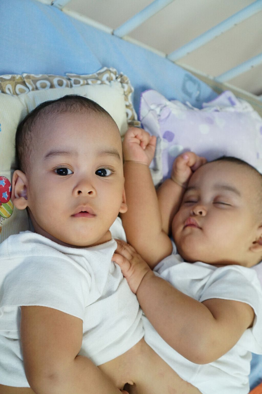 Bayi kembar siam Adam dan Malik dirawat di Rumah Sakit Umum Pusat H Adam Malik, Medan, Sumatera Utara, Senin (15/7/2019).