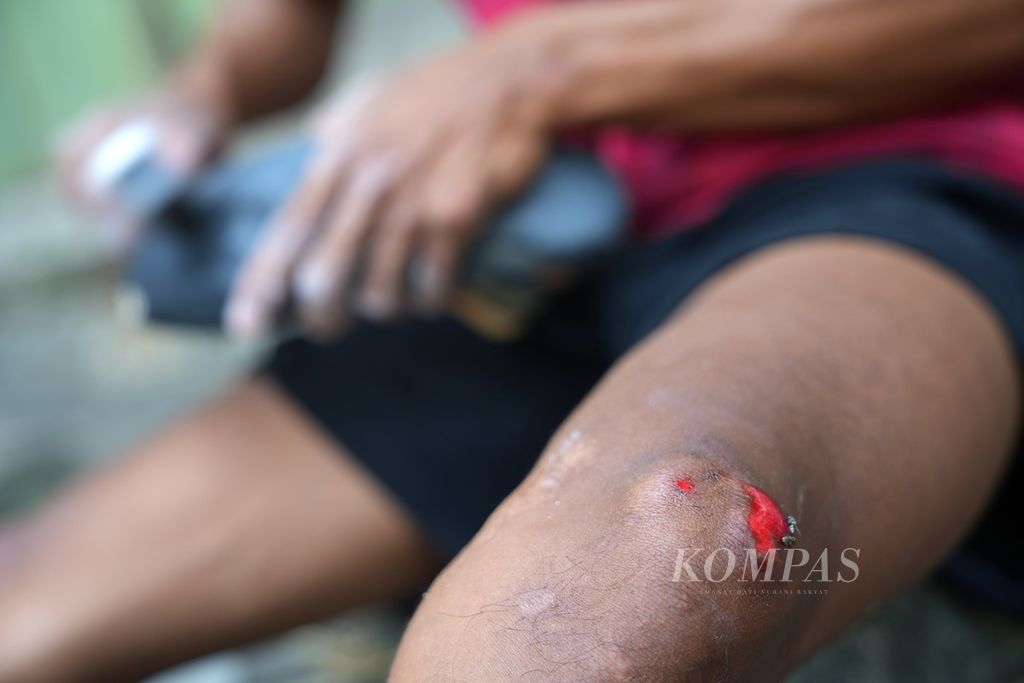 Dua lalat menghampiri pinggiran luka yang darahnya mulai mengering di kaki kiri Erwin (21) saat berlatih nomor kecepatan di Hotel Santika Premiere, Kota Harapan Indah, Kota Bekasi, Jawa Barat, Rabu (14/8/2024). 