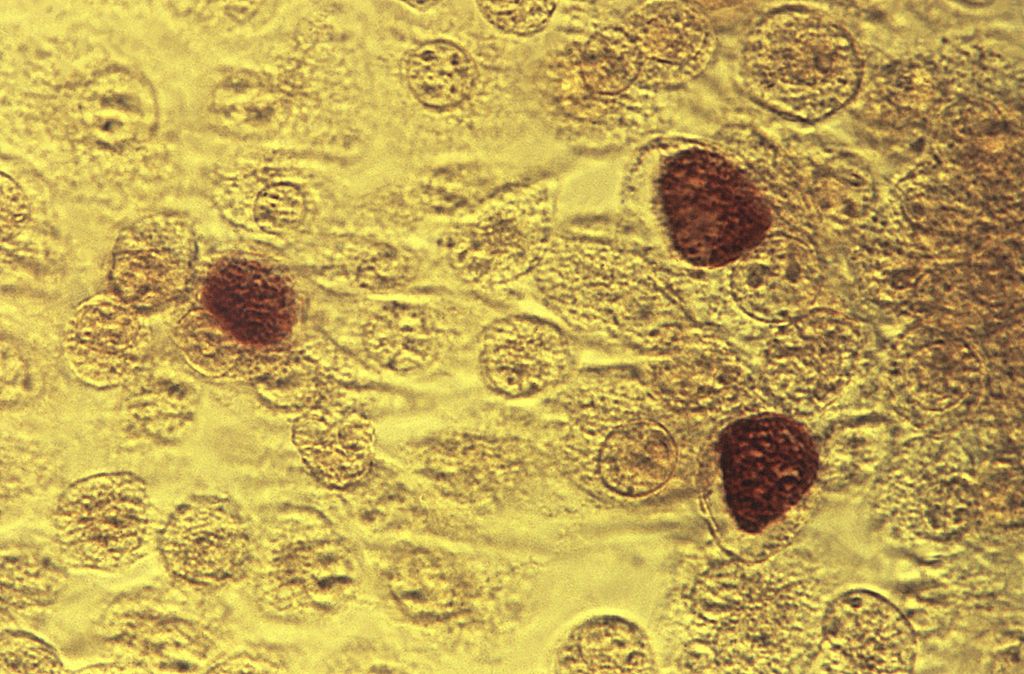 Gambar mikroskop tahun 1975 yang disediakan Pusat Pengendalian dan Pencegahan Penyakit ini menunjukkan bakteri <i>Chlamydia trachomatis. </i>