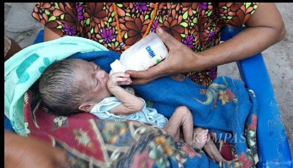 Seorang anak penderita gizi buruk kategori kwashiorkor di Kupang. Kasus kemiskinan di NTT berdampak luas. Tidak hanya melahirkan perdagangan orang, tetapi juga gizi buruk dan tengkeng.